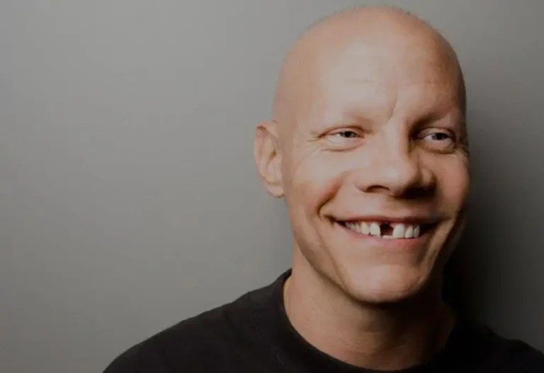 funny names for people with no teeth