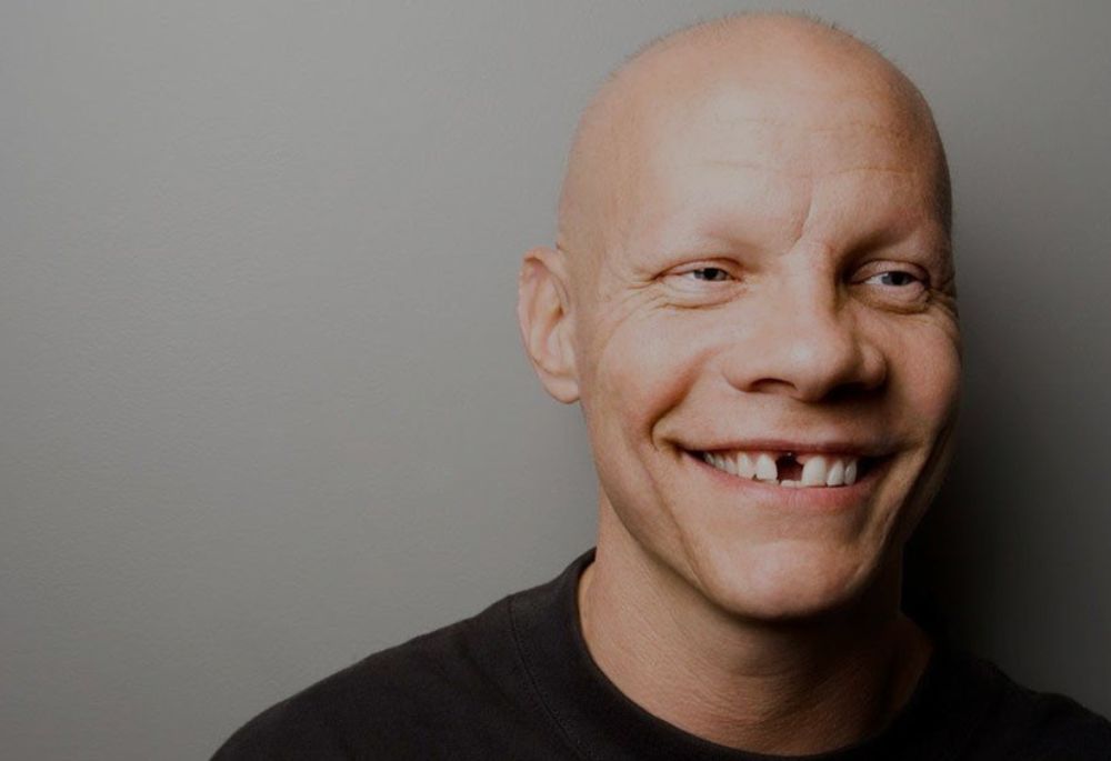 funny names for people without teeth