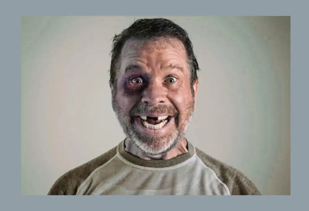 funny names for people with no teeth